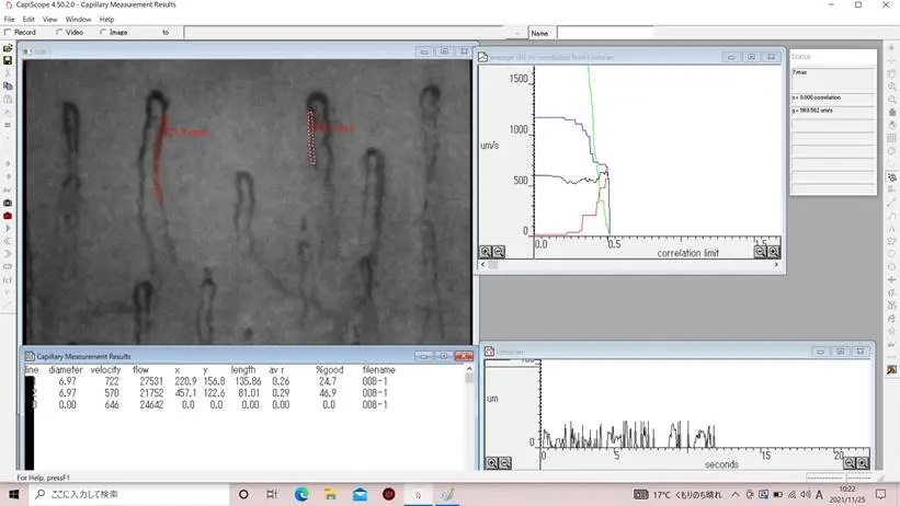 【Capimetrics】流速(Blood Flow Velocity)